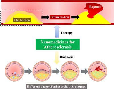 Editorial: Advances on targeted nanomedicines for atherosclerosis